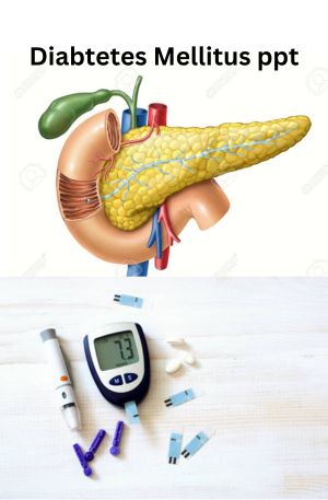 Diabetes Mellitus Ppt Emedicodiary