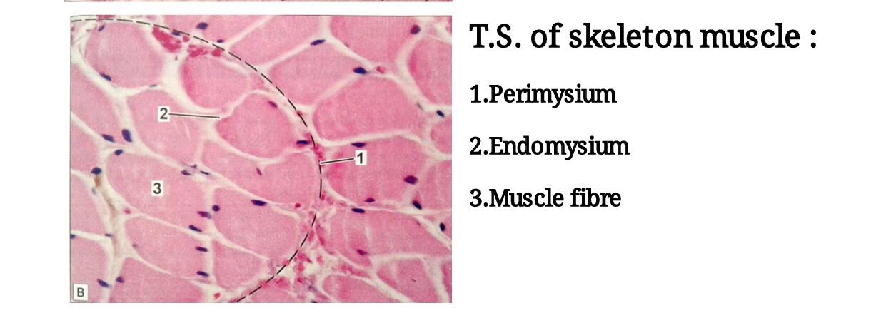 T.S of skeletal muscle