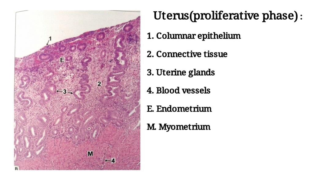 Ideal slide of uterus 