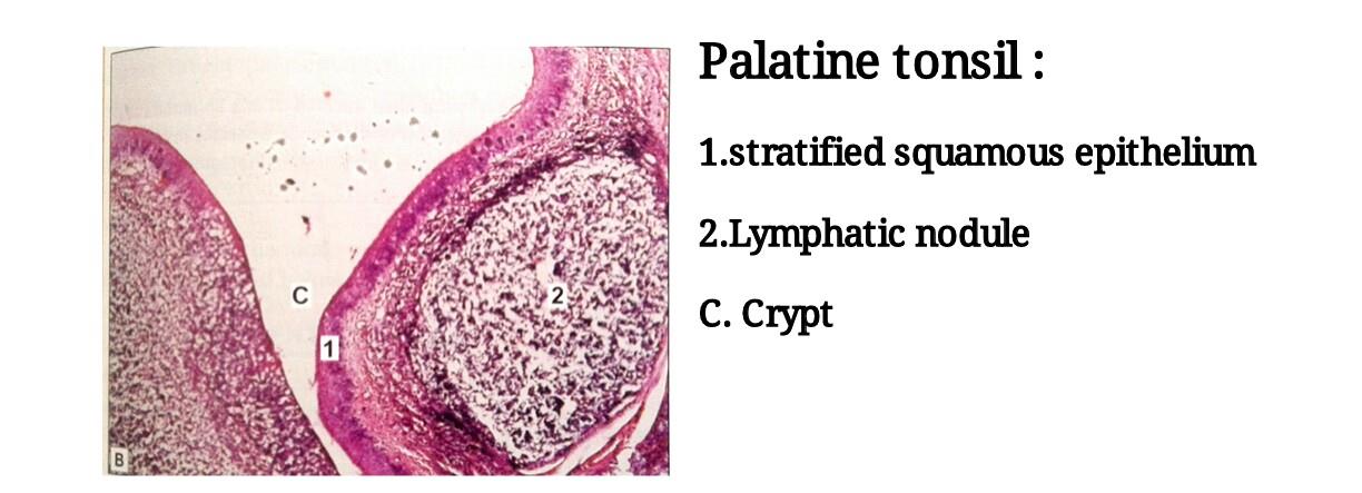 Ideal slide of palatine tonsil