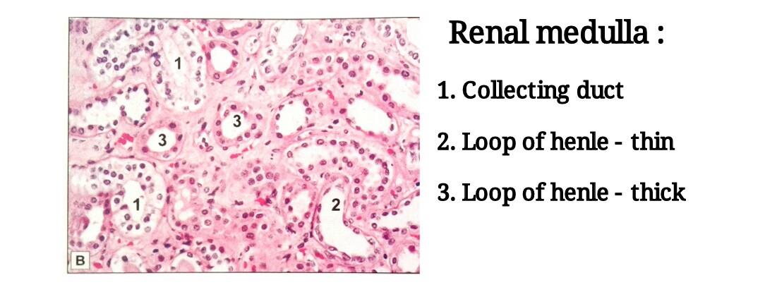 Ideal slide if renal medulla 