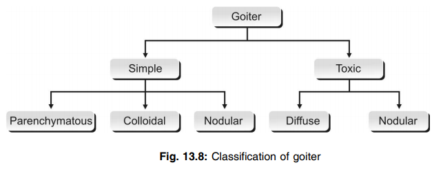 Classification of goiter Growth Hormone that causes the blood sugar level to increase
