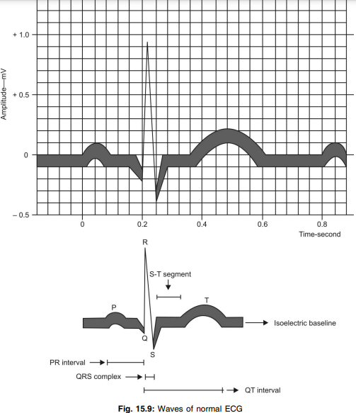 Wave of normal ECG 