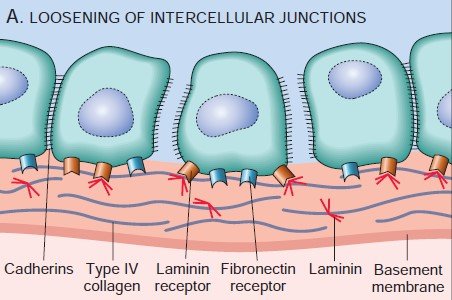 Detachment of tumor cells from each other