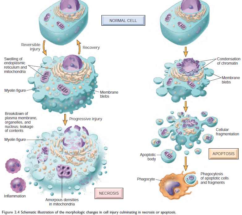 Morphologic changes in necrosis and apoptosis