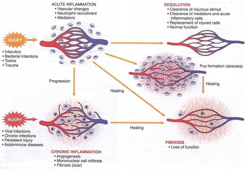 Outcomes of acute inflammation