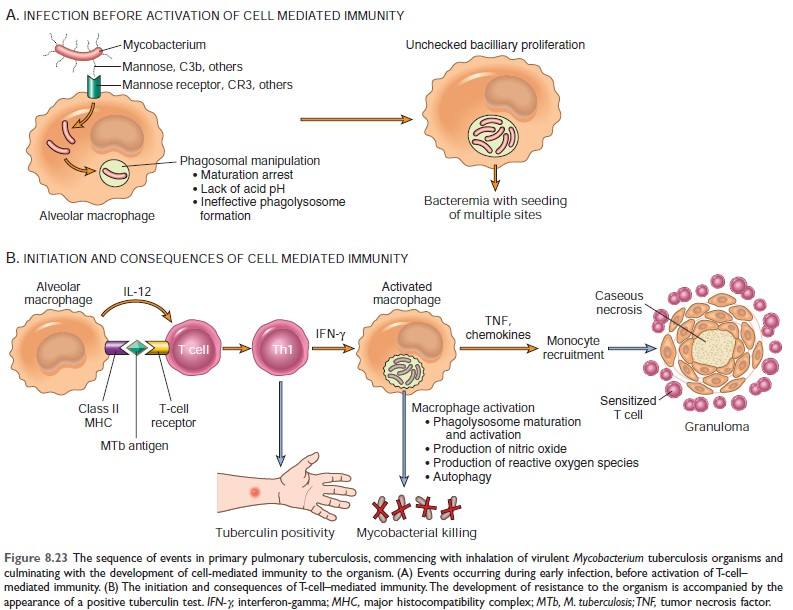 Mechanism of granuloma formation in TB Robbins