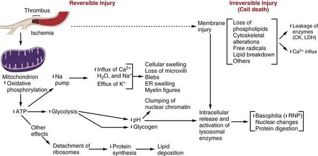 Sequence of events in reversible and irreversible cell injury