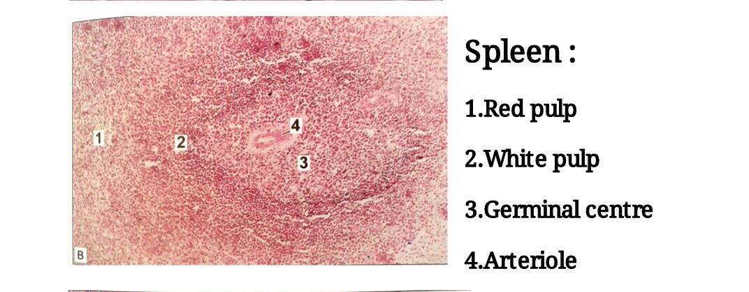 Ideal slide of spleen 