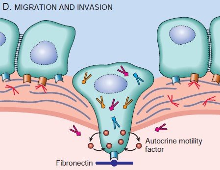 Migration of tumor cell