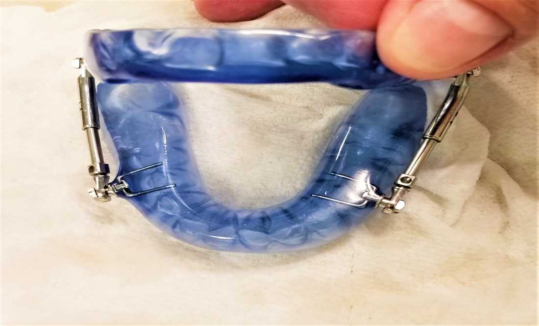 Sleep Apnea on the Go: How Oral Appliances Make Traveling Easier