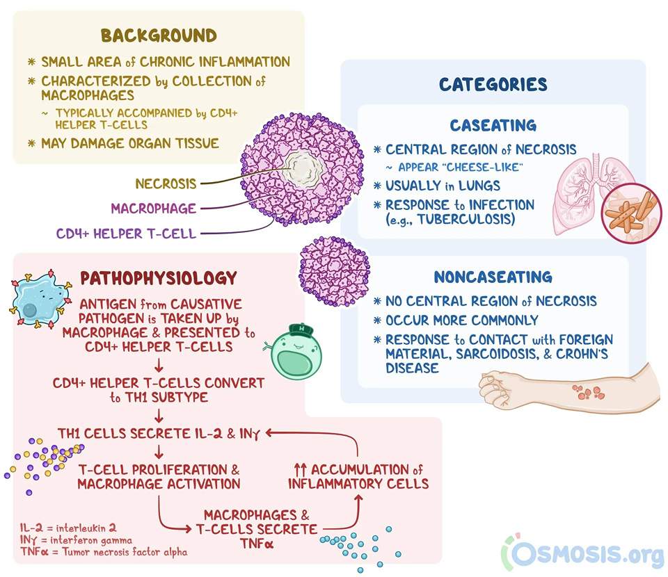 Mechanism of granuloma formation