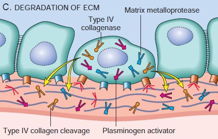 Degradation of ECM by tumor