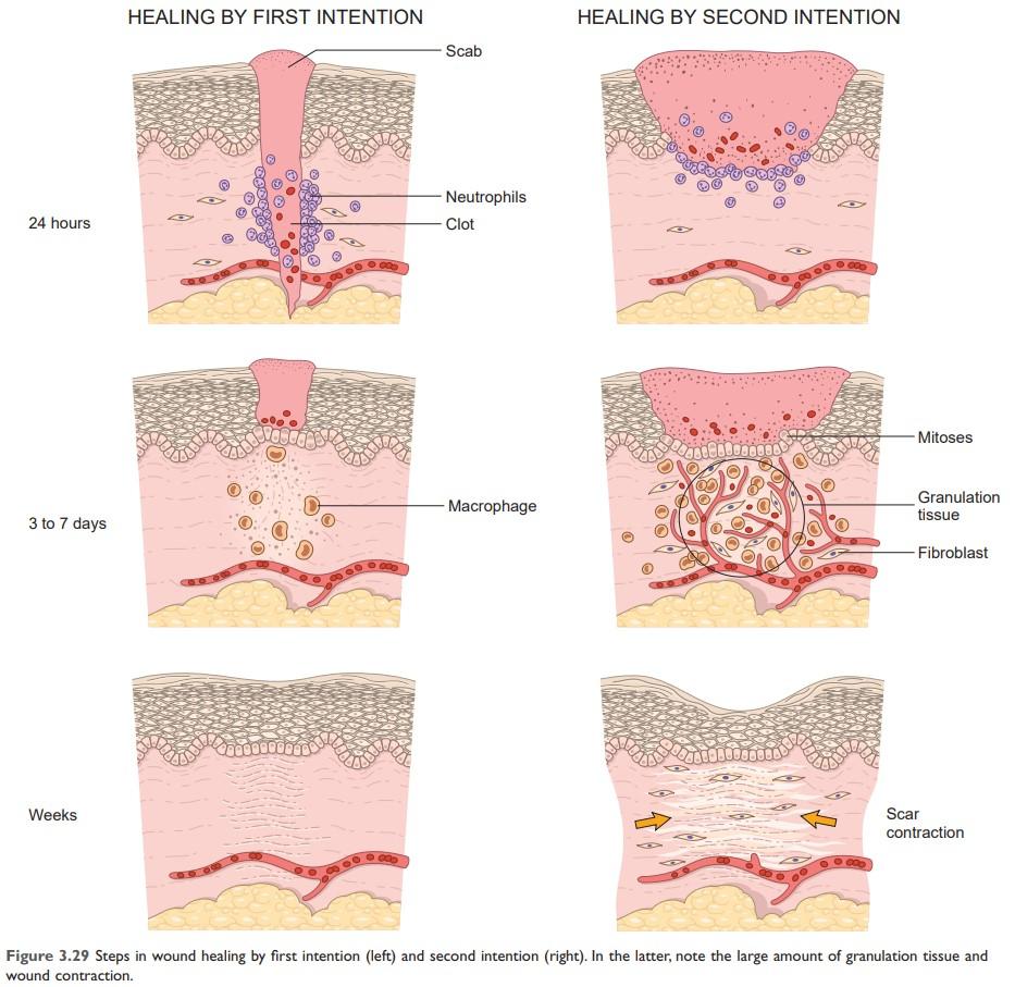 Wound healing stages