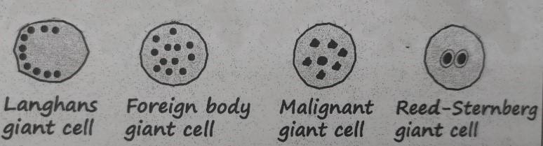 Giant cells