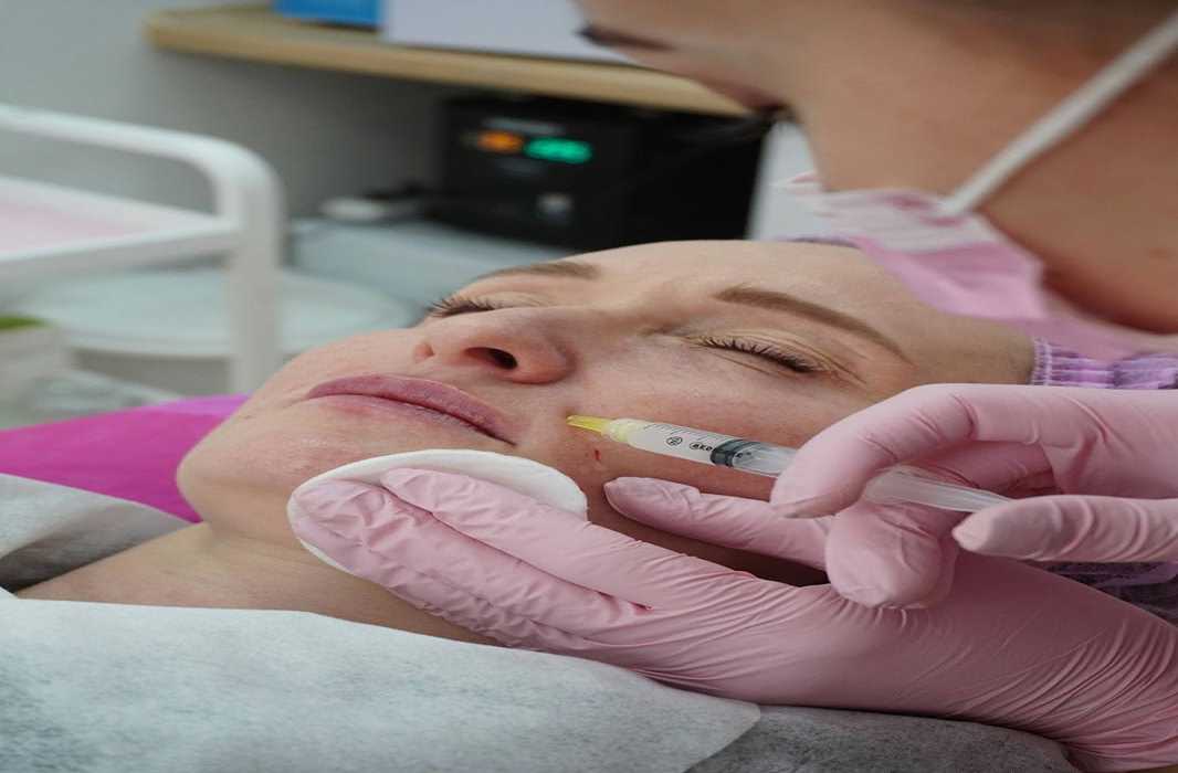 Botox for Beginners: How to Prepare for Your First Session