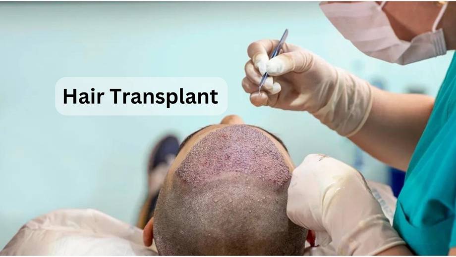 Hair Transplant In Lahore, Karachi & Faisalabad