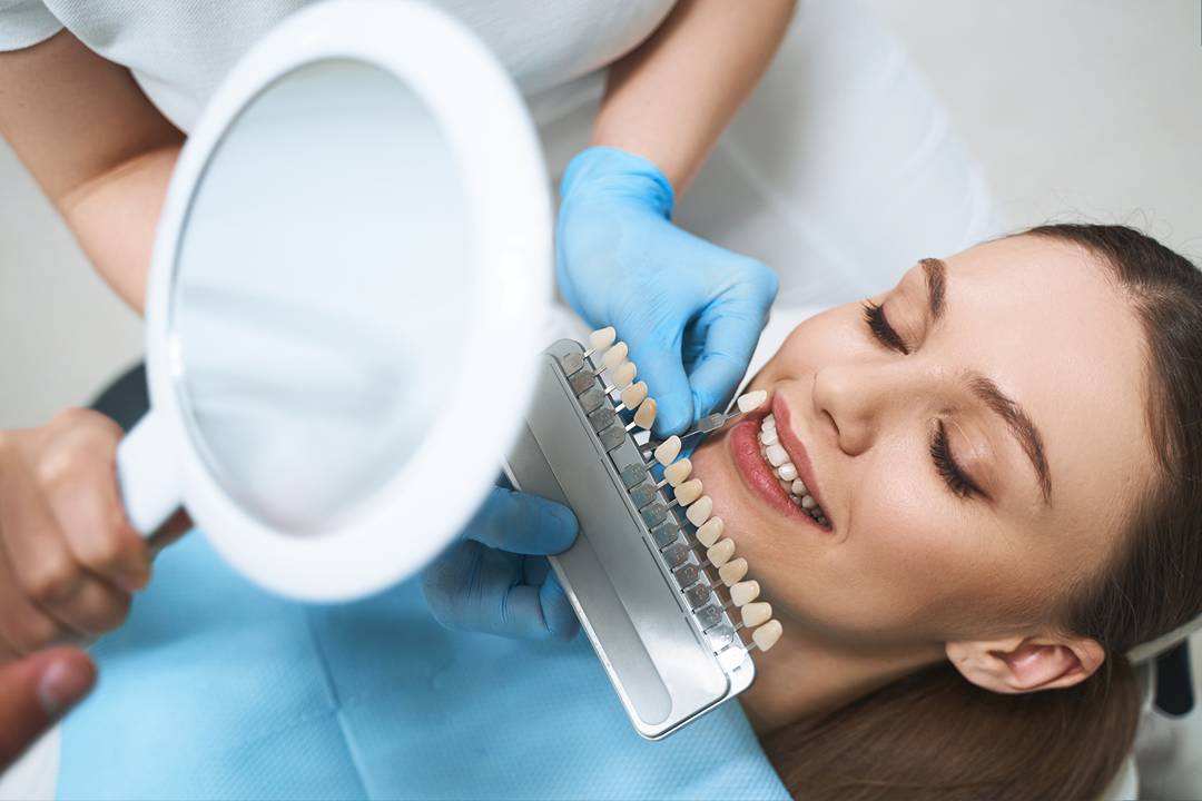 Understanding the benefits of dental veneers in Thousand Oaks