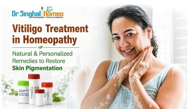 Vitiligo Treatment in Homeopathy: A Natural Approach to Skin Restoration