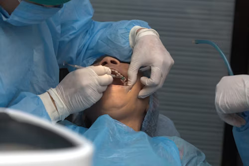 Your Complete Guide to Wisdom Teeth Removal: What to Expect