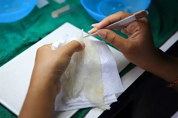 What Surgeons Should Consider When Selecting a Tissue Repair Graft