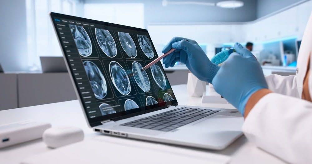 The Expenses Many Brain Injury Victims Forget to Include in Their Claims