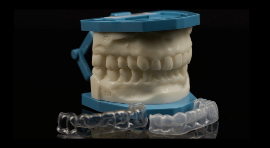 The Role of Diagnostic Wax-Ups like TRIAD in Smile Design and Full Mouth Rehabilitation