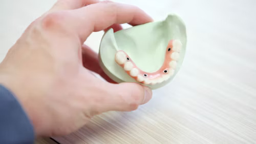 Long-Term Health Benefits Of All-On-4 Dental Implants