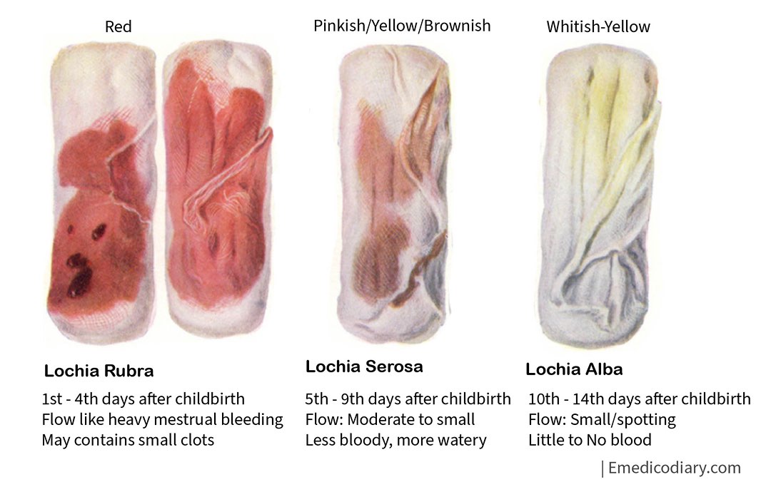 Lecturio Nursing - Lochia is the vaginal discharge produced after