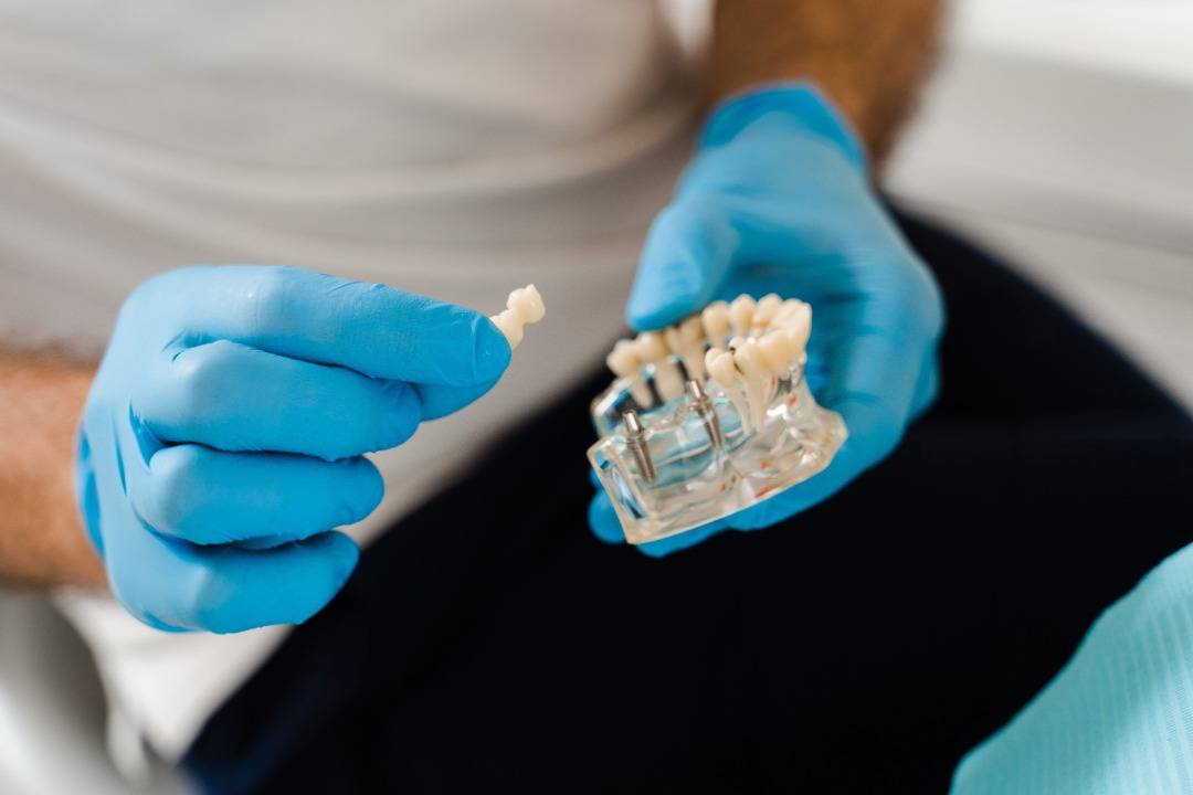 Which Dental Implant Is Right for You?