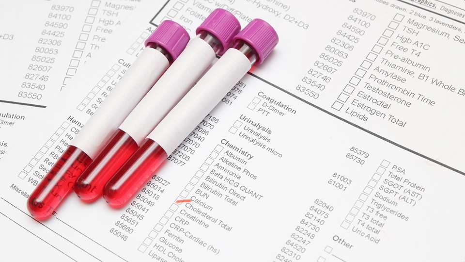 Important Tests To Take To Know Your Health Status - Emedicodiary