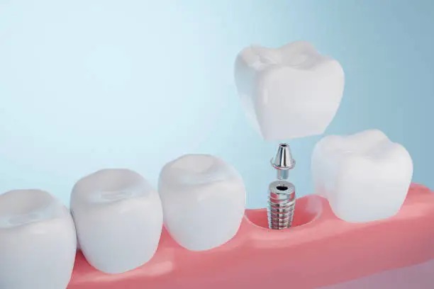 Modern Dental Techniques to Transform Patient Experience 