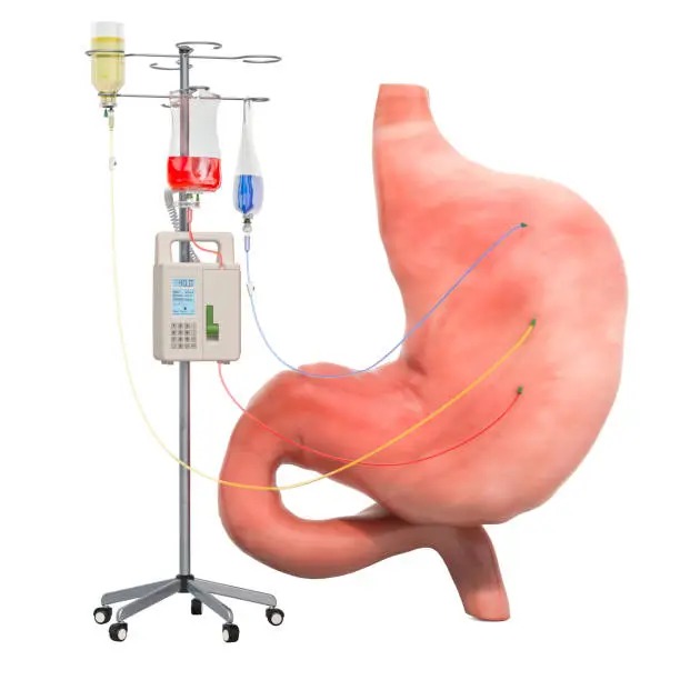 Gastric Bypass Diet 10 Years Later