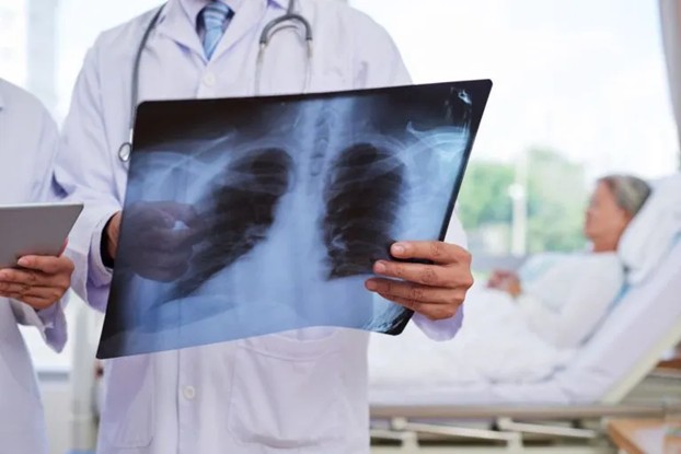 Signs of Chest Injury After a Car Accident