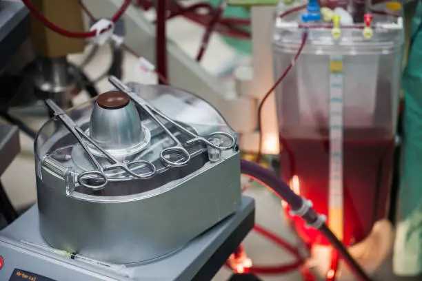 Robotic Kidney Transplant: A New Era in Advanced Kidney Failure Treatment