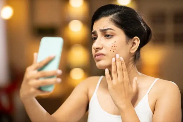 The Ultimate Guide to a Salicylic Acid Gel Routine