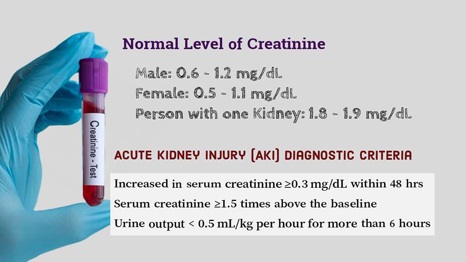 Low Creatinine Levels In Urine Drug Test Ovus Medical