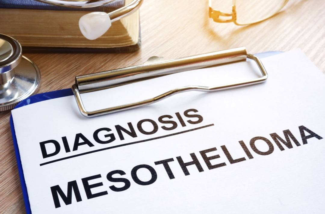 How to Deal With a Mesothelioma Diagnosis