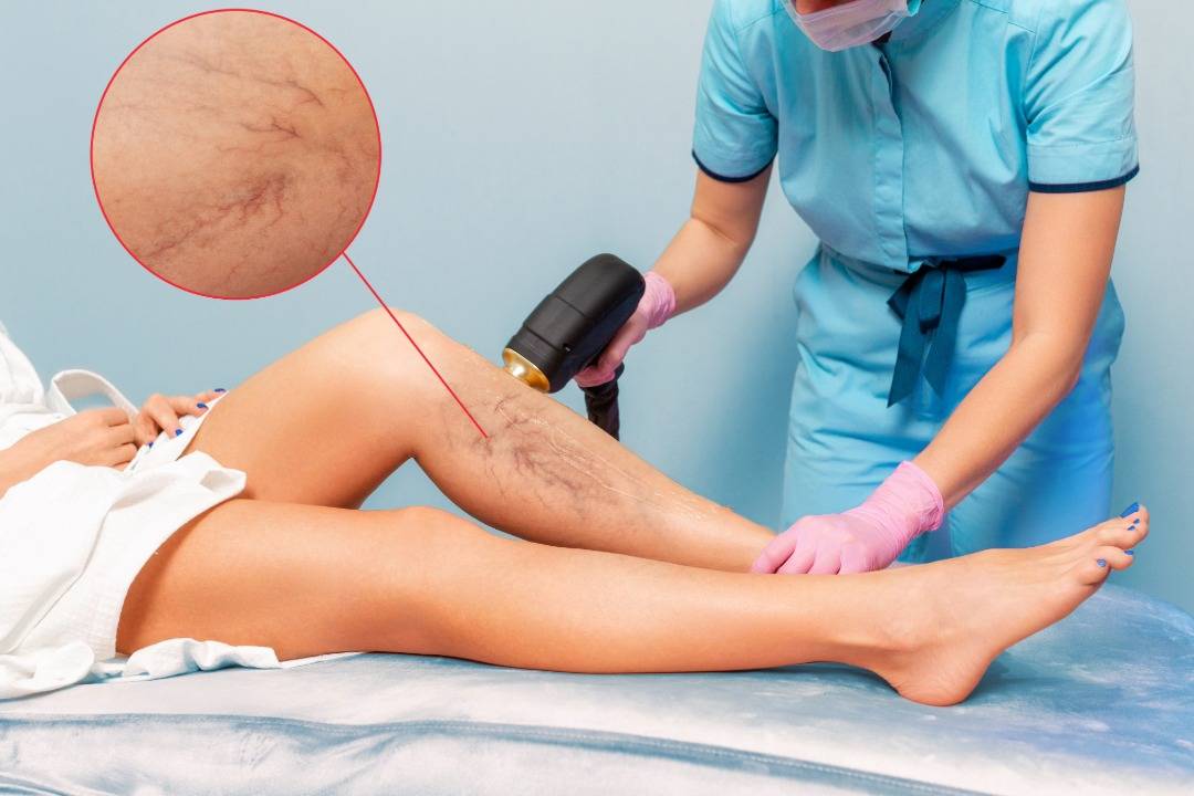 Restoring Confidence and Comfort: The Importance of Modern Vein Treatment