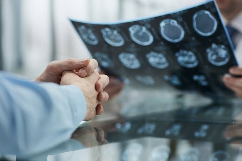 Will Your Brain Injury Affect You for Life? Know Before You Settle