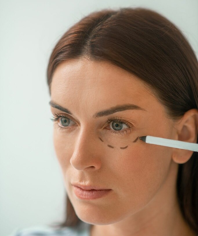 Transconjunctival Blepharoplasty in Turkey by Board-Certified Oculoplastic Surgeon Dr. Yildiz Acar Ebcim