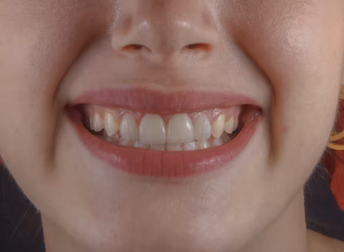 How Aesthetic Dentistry Can Boost Your Career and Social Life