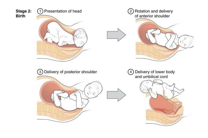 second-stage-of-labor-emedicodiary