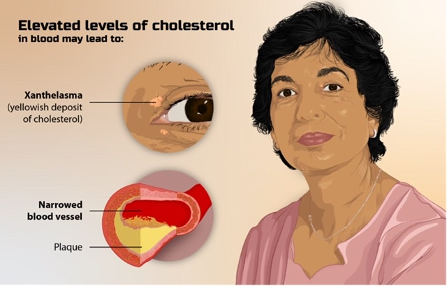 Lipid & it's metabolism [Part 1] (Viva)