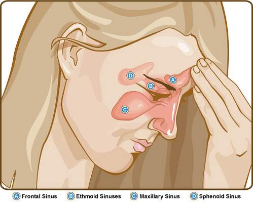Nose & Paranasal Sinuses