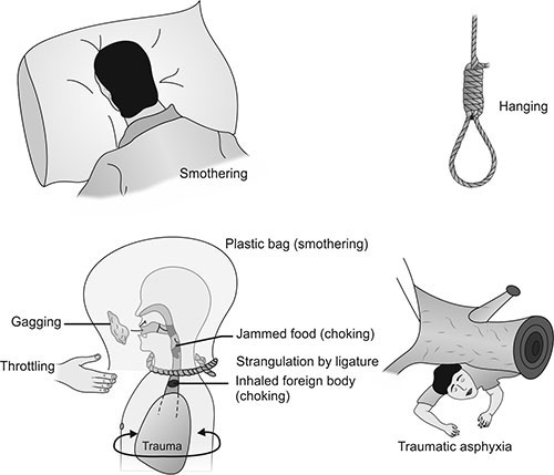 manual strangulation marks